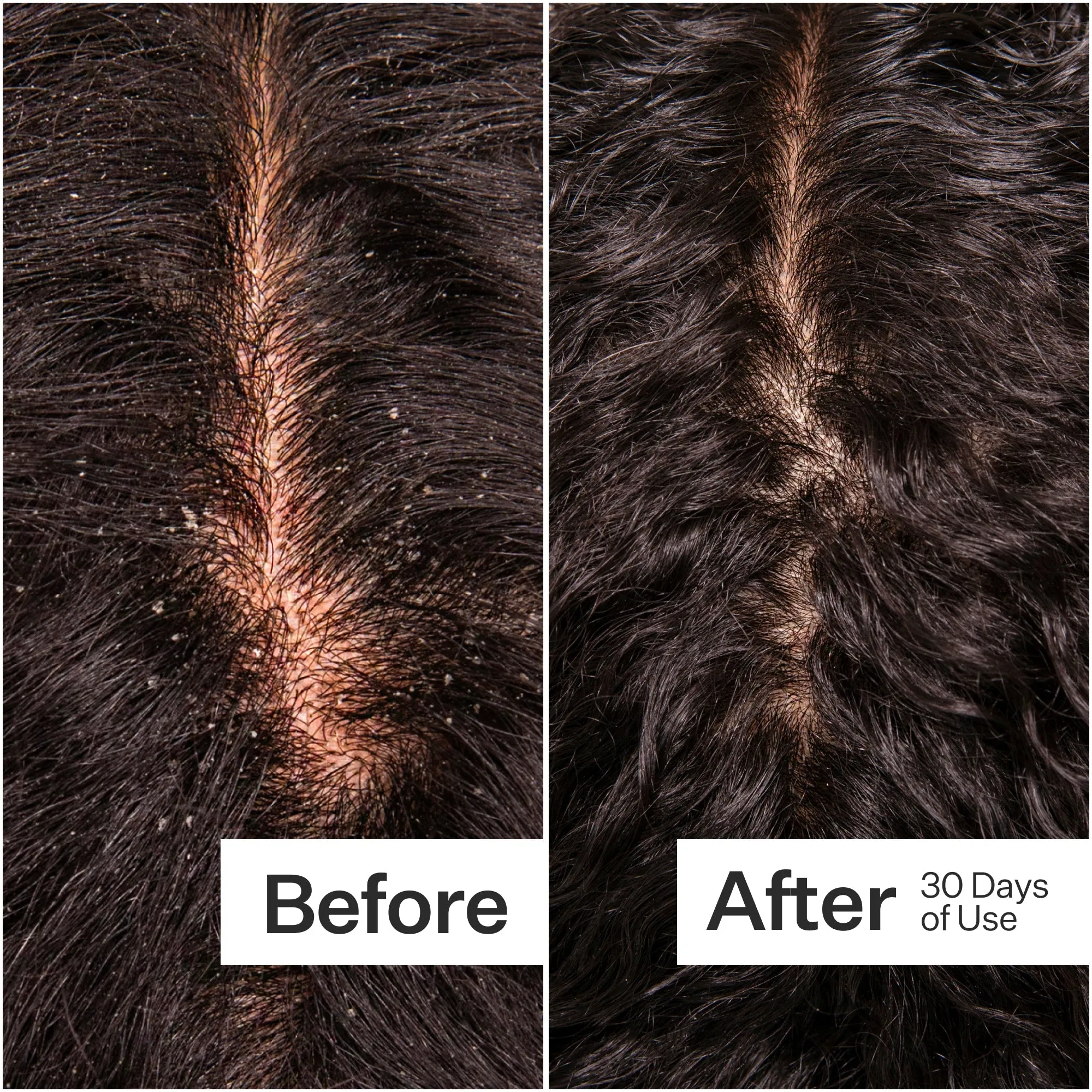 Act   Acre Microbiome Cooling Scalp Serum