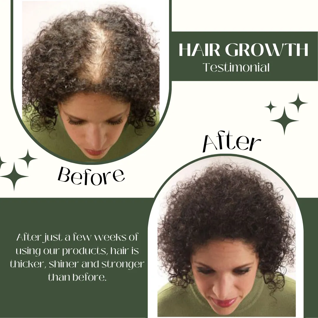 Ginger Hair Growth Spray Thickness, Shine, and Strength- Herbishh